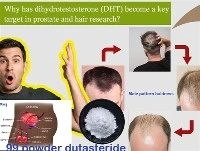 DHT가 전립선 및 모발 연구의 주요 표적이 된 이유