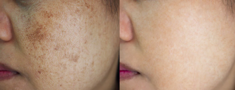Sepiwhite MSH Powder effect