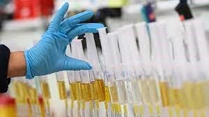 GW 501516 WADA Testing GW 501516 WADA Testing